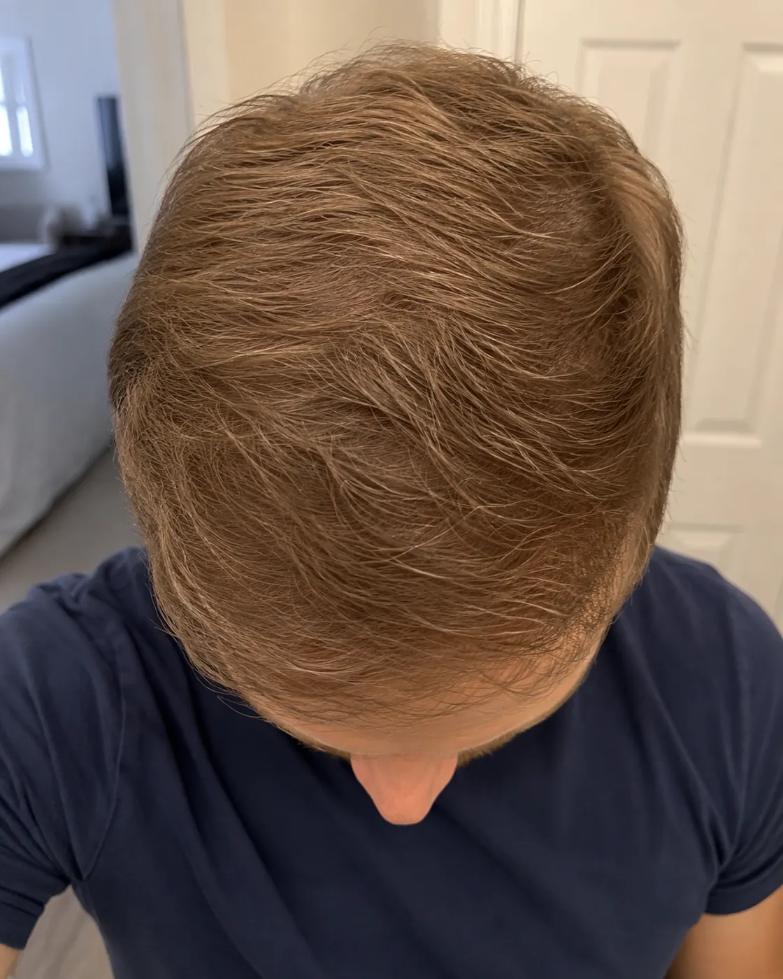 Scalp after consistent nightly use