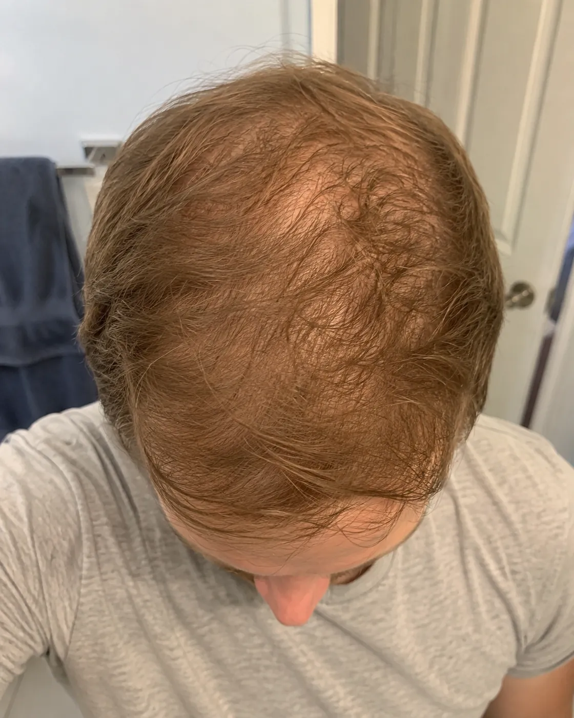 Scalp before starting the nightly ritual